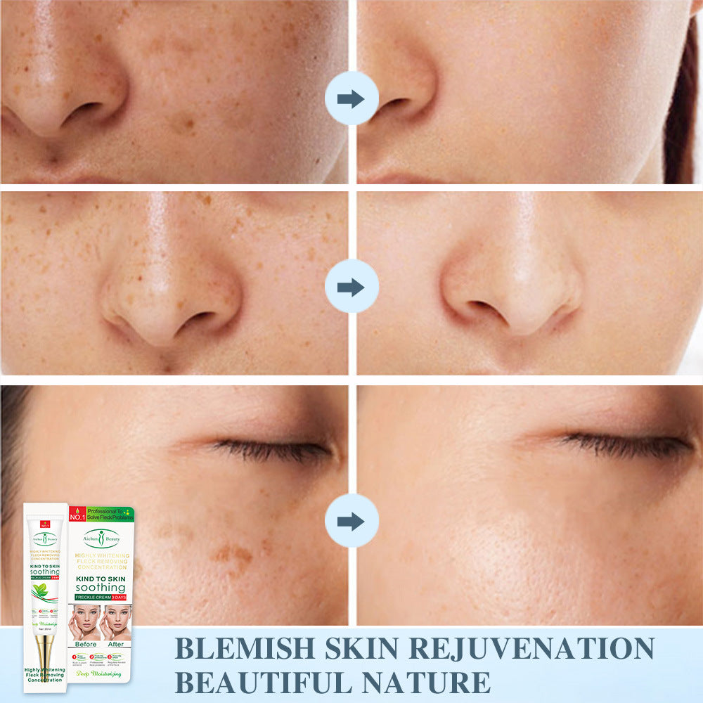 Men And Women Skin Lifting Cosmetics Anti-Spot Cream - White / 30ml